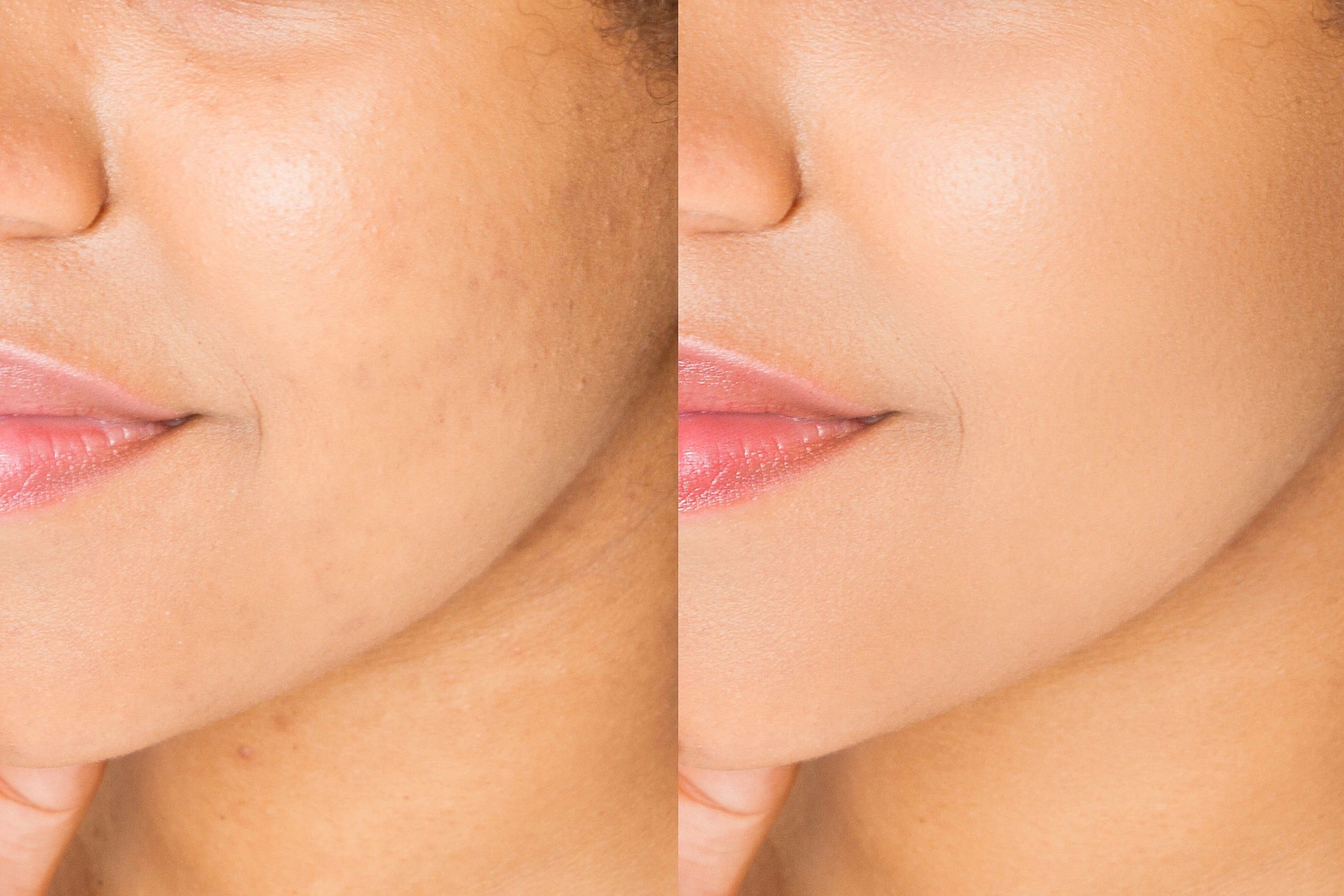 Youthful radiance restored—gentle anti-aging treatments for naturally refreshed results.