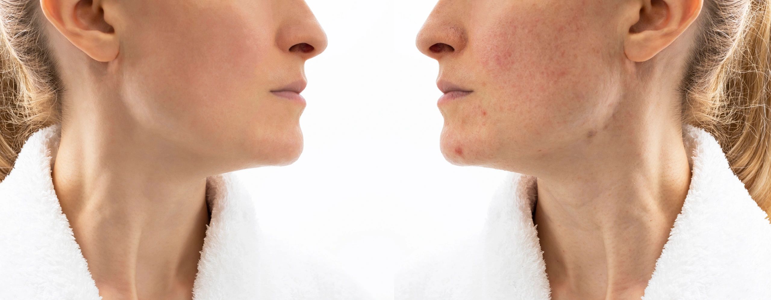 Brighter, smoother skin after personalized facial care—see the renewed glow and confidence.